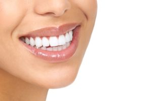 invisalign vs. smile direct club coral springs fl