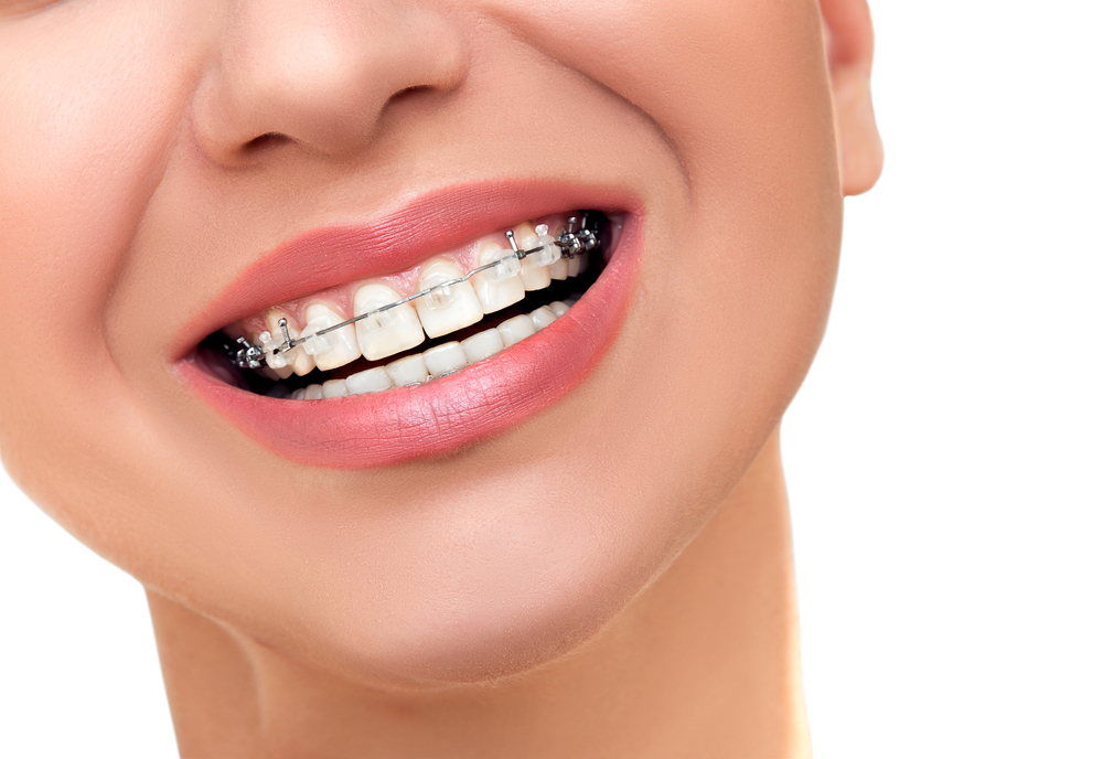 Orthodontist Boca Raton FL John Orthodontics Explore Treatment Options